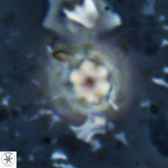 Olladiscoaster lepidus 30990