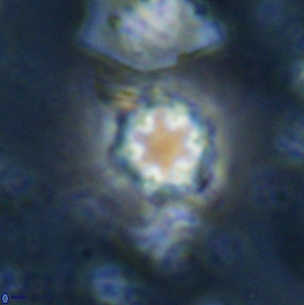 Olladiscoaster lepidus 30991