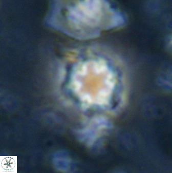 Olladiscoaster lepidus 30991