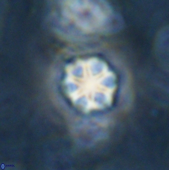 Olladiscoaster lepidus 30992