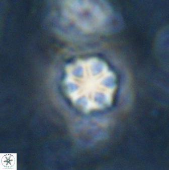 Olladiscoaster lepidus 30992