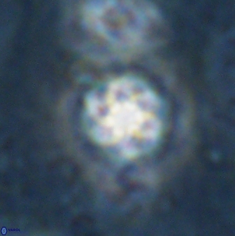 Olladiscoaster lepidus 30993