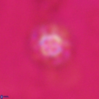 Olladiscoaster lepidus 31003