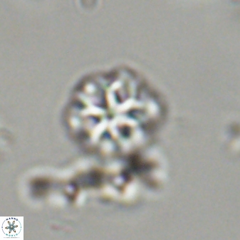 Olladiscoaster lepidus 32894