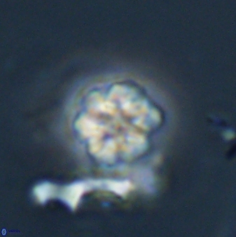 Olladiscoaster lepidus 32896