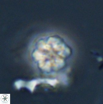 Olladiscoaster lepidus 32896