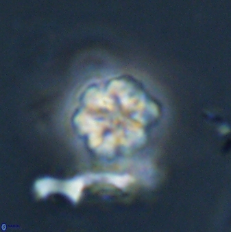 Olladiscoaster lepidus 32897