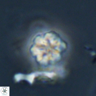 Olladiscoaster lepidus 32897
