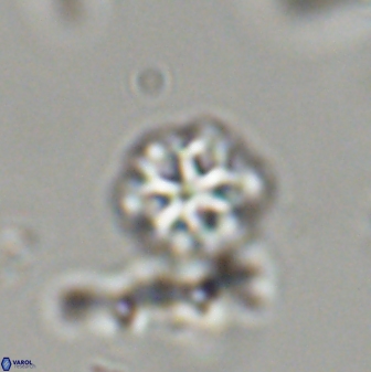 Olladiscoaster lepidus 32892