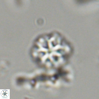 Olladiscoaster lepidus 32892
