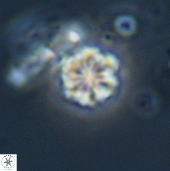Olladiscoaster lepidus 32905