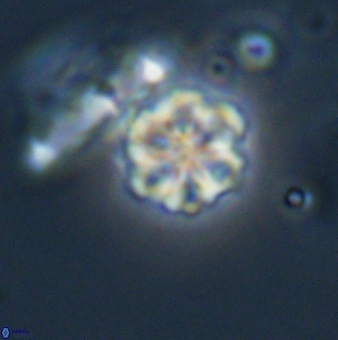 Olladiscoaster lepidus 32906