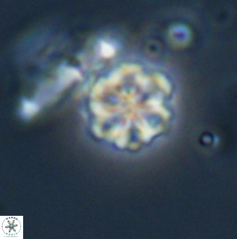 Olladiscoaster lepidus 32906
