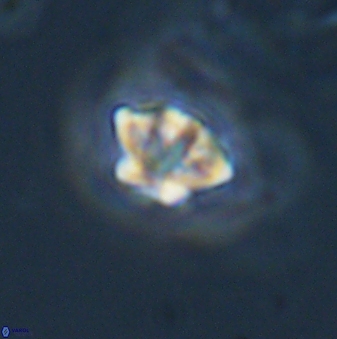 Olladiscoaster lepidus 32902