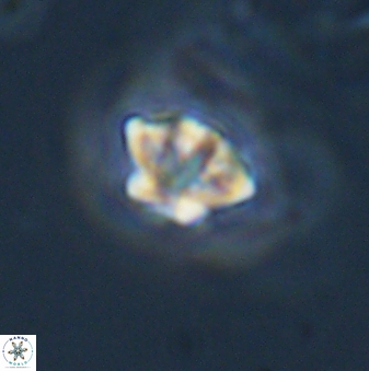 Olladiscoaster lepidus 32902