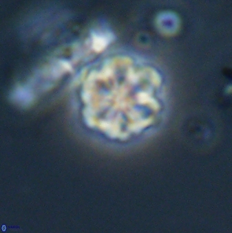 Olladiscoaster lepidus 32903