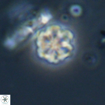 Olladiscoaster lepidus 32903