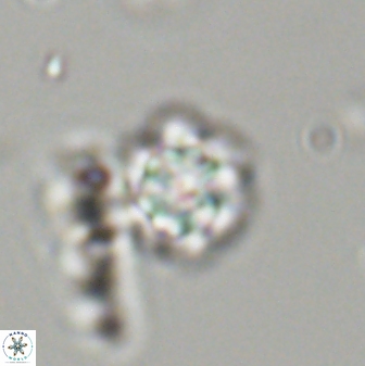 Olladiscoaster lepidus 32924