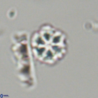 Olladiscoaster lepidus 32925