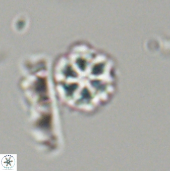 Olladiscoaster lepidus 32925
