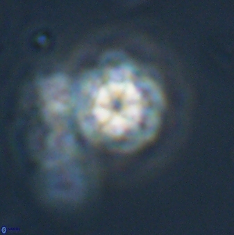 Olladiscoaster lepidus 32927