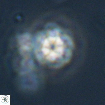 Olladiscoaster lepidus 32927