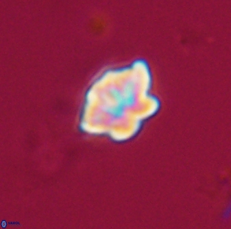 Olladiscoaster lepidus 32921