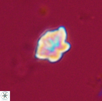 Olladiscoaster lepidus 32921