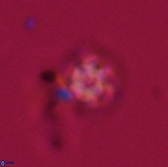 Olladiscoaster lepidus 32922