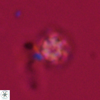 Olladiscoaster lepidus 32922