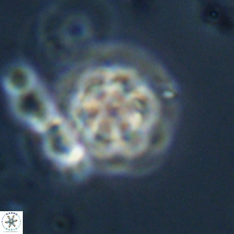 Olladiscoaster lepidus 32934
