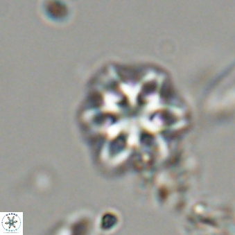 Olladiscoaster lepidus 32936