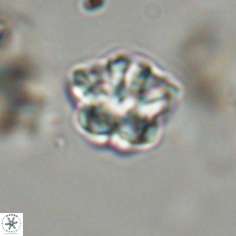 Olladiscoaster lepidus 32937