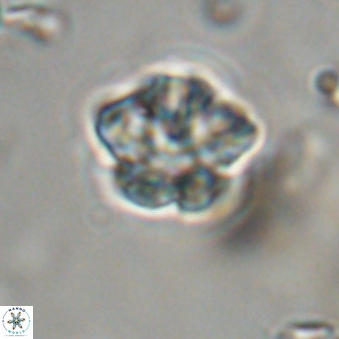 Olladiscoaster lepidus 32938