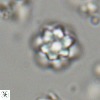 Olladiscoaster lepidus 32939
