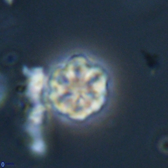 Olladiscoaster lepidus 32930