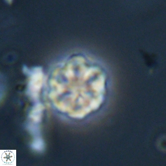 Olladiscoaster lepidus 32930