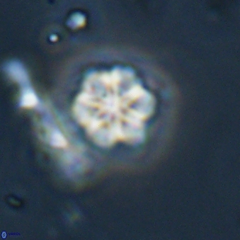 Olladiscoaster lepidus 32932