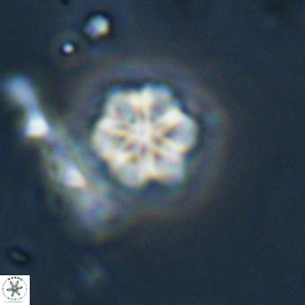 Olladiscoaster lepidus 32932