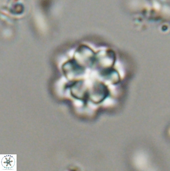 Olladiscoaster lepidus 32944