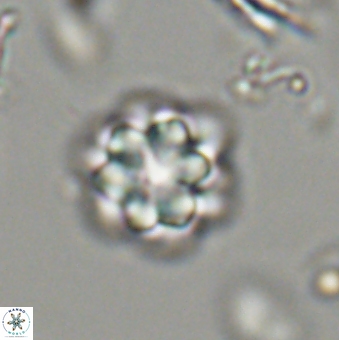 Olladiscoaster lepidus 32945