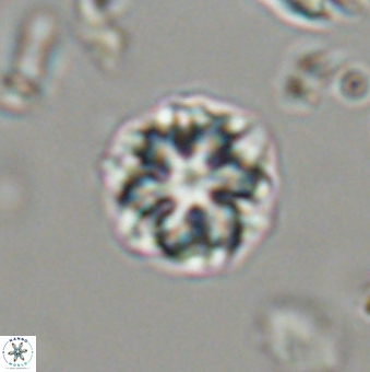 Olladiscoaster lepidus 32946