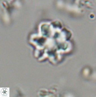 Olladiscoaster lepidus 32941