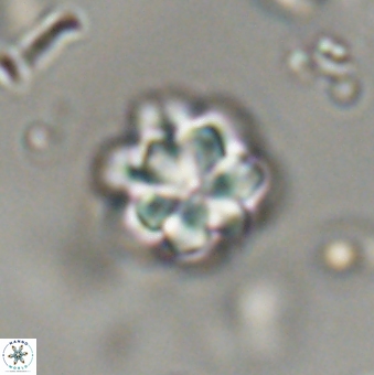 Olladiscoaster lepidus 32942