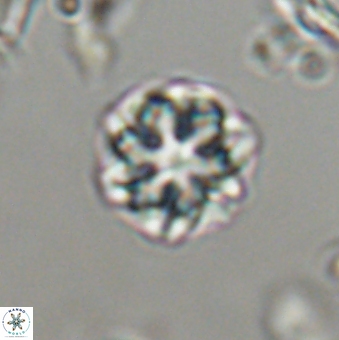 Olladiscoaster lepidus 32943