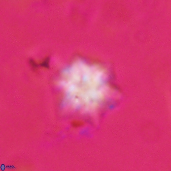 Olladiscoaster molae 31117