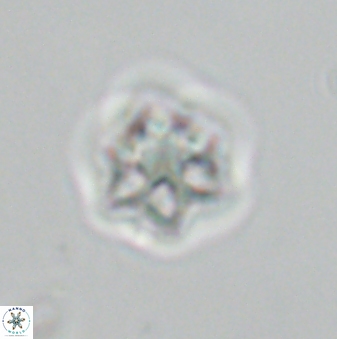 Olladiscoaster molae 32307