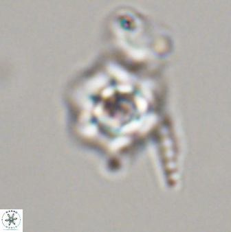 Olladiscoaster molae 32442