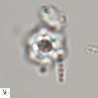 Olladiscoaster molae 32443