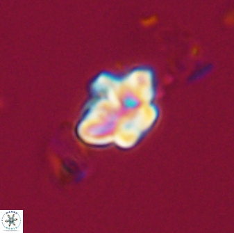 Olladiscoaster molae 32452